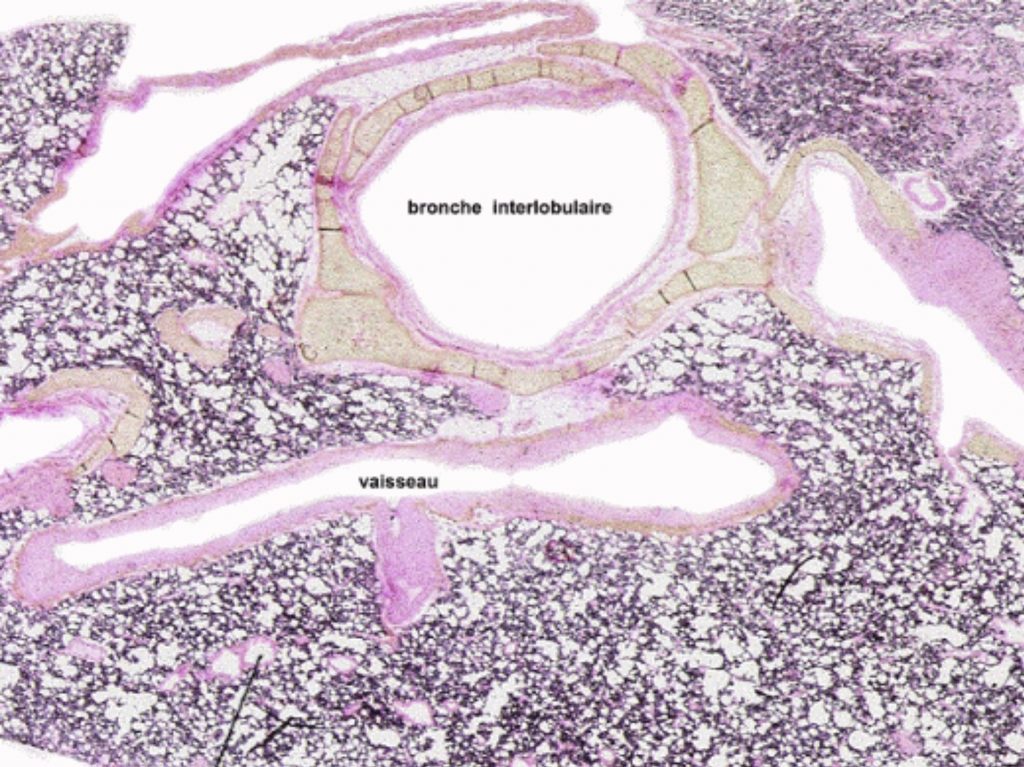 Le Poumon Laboratoire Dhistologie Et Dembryologie